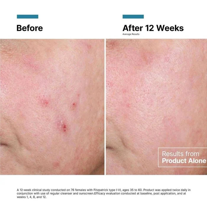 Advanced RGN 6 Skin Regeneration Anti Aging Cream - 50ml
