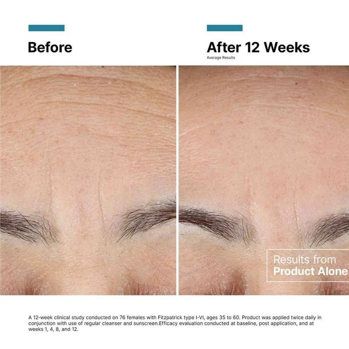 Advanced RGN 6 Skin Regeneration Anti Aging Cream - 50ml