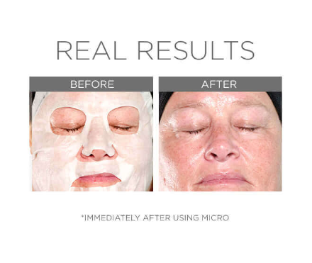 Cosmedix Skin Care Cosmedix Micro Defense Sheet Mask