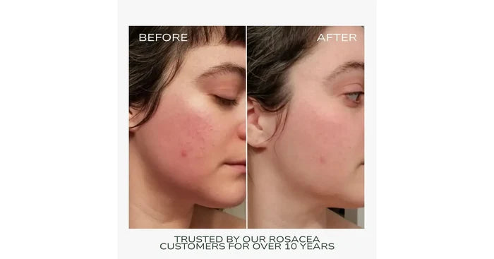 Fitglow Redness Rescue Cream (RRC) (45ml)