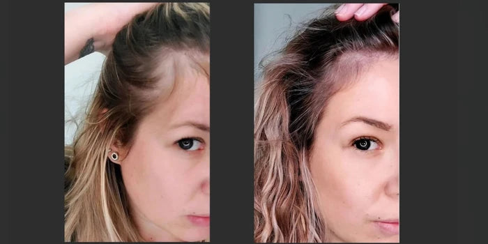Hair Growth Mask for Thinning Hair & Scalp HealthThe Hair Fuel