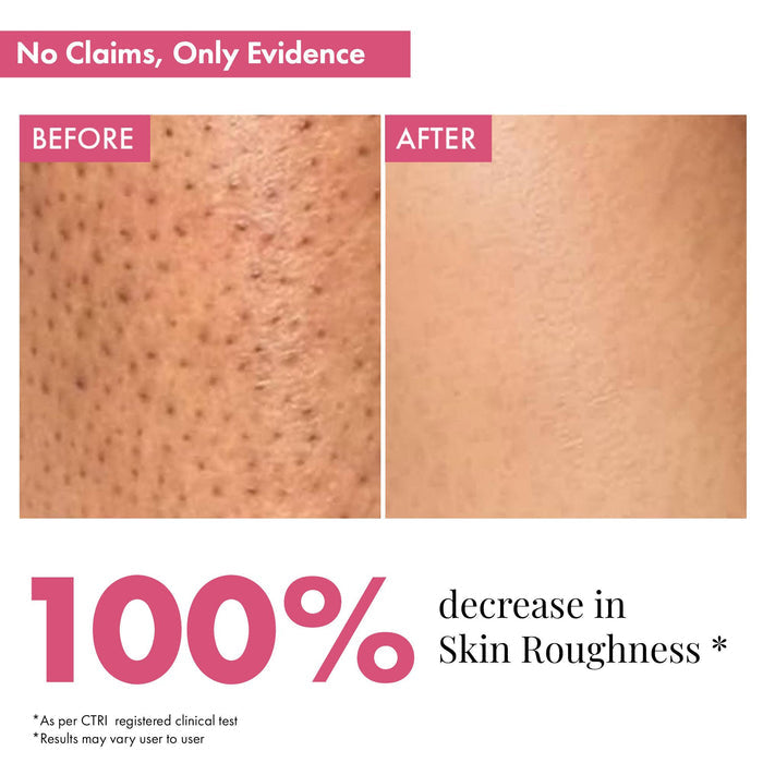 Skin Smoothening Bumps Eraser Exfoliating Body Scrub, 100ml