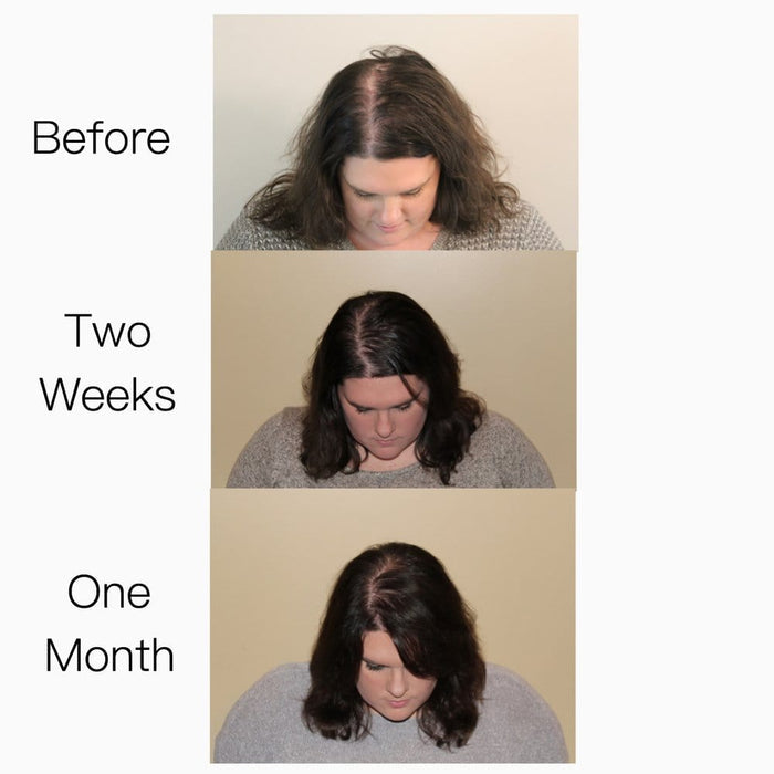 Elleada Vegan Hair Strengthening Serum – Natural Relief for Hair Loss & Itchy Scalp