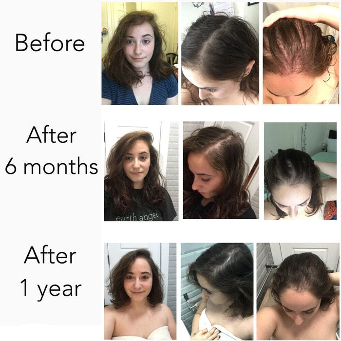 Elleada Vegan Hair Strengthening Serum – Natural Relief for Hair Loss & Itchy Scalp